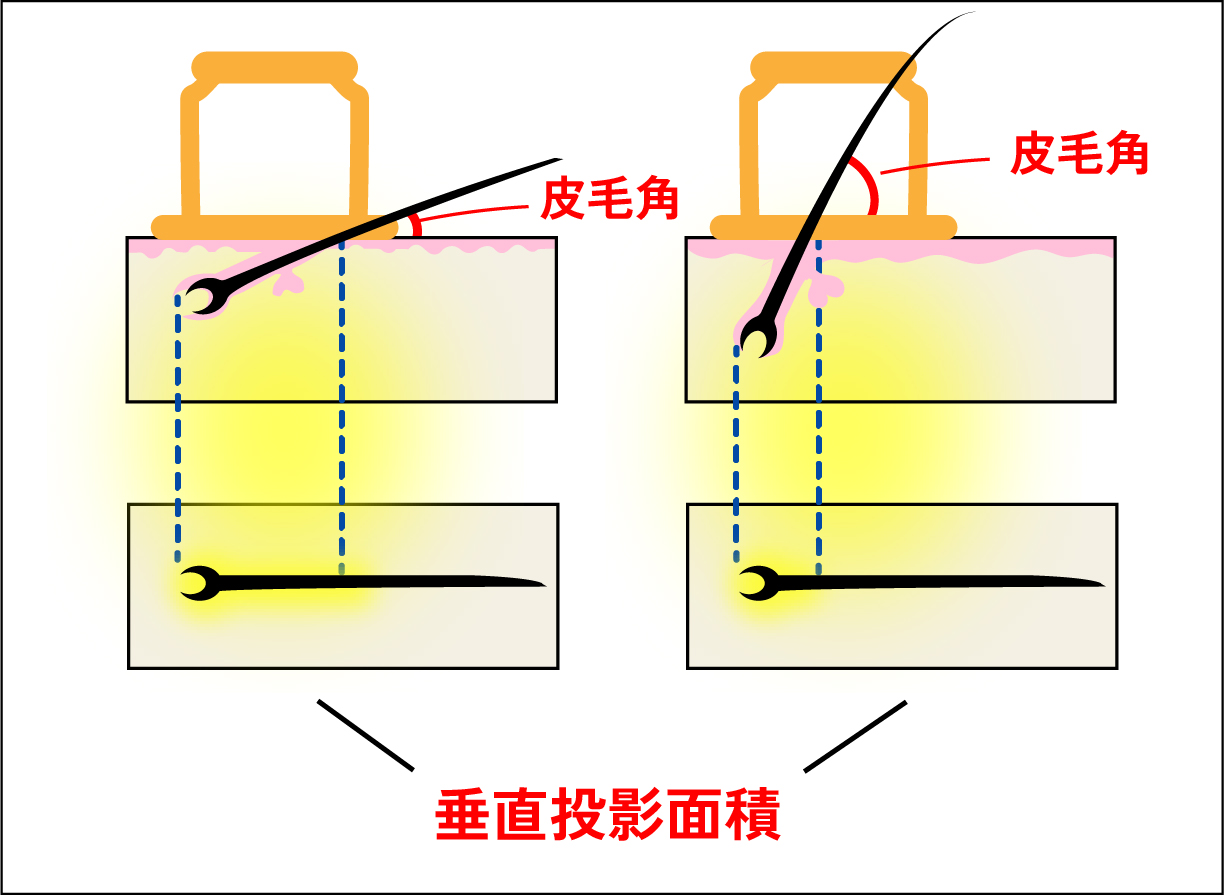 point1-fig1