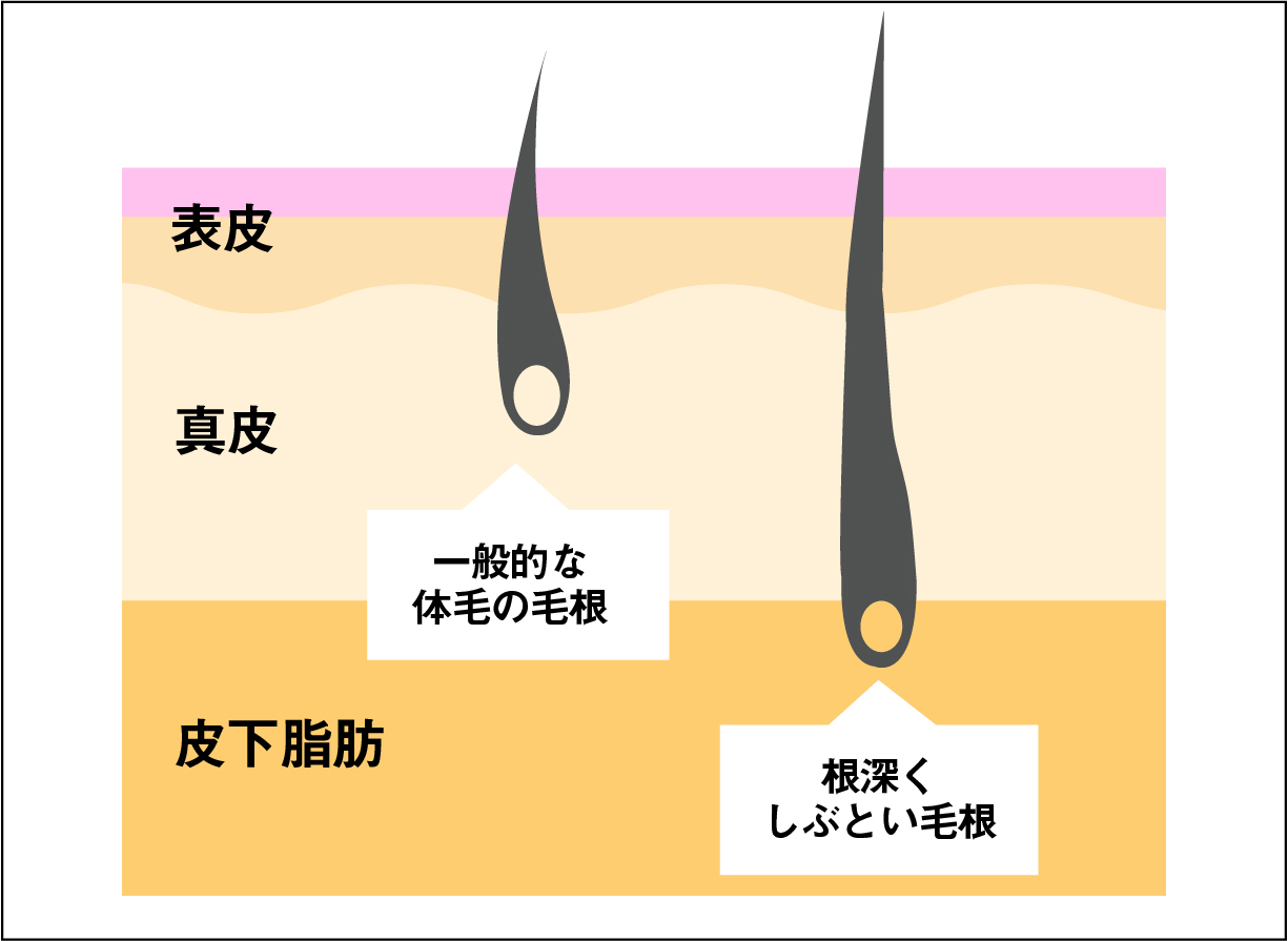 point1-fig1