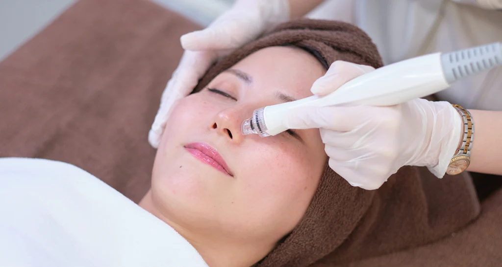 毛穴 | 立川駅北口 今井皮フ形成外科クリニック