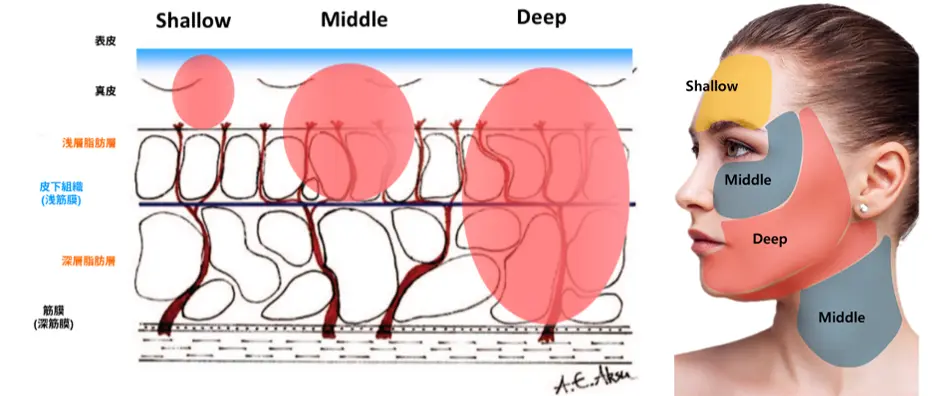 XERF（ザーフ）は立川駅北口 今井皮フ形成外科（東京都立川市）