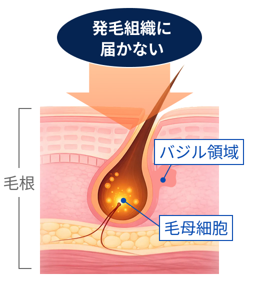 発毛組織に届かない