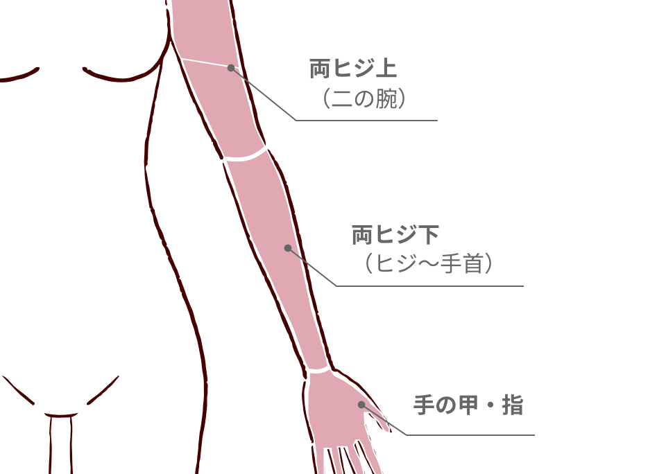 about-arm