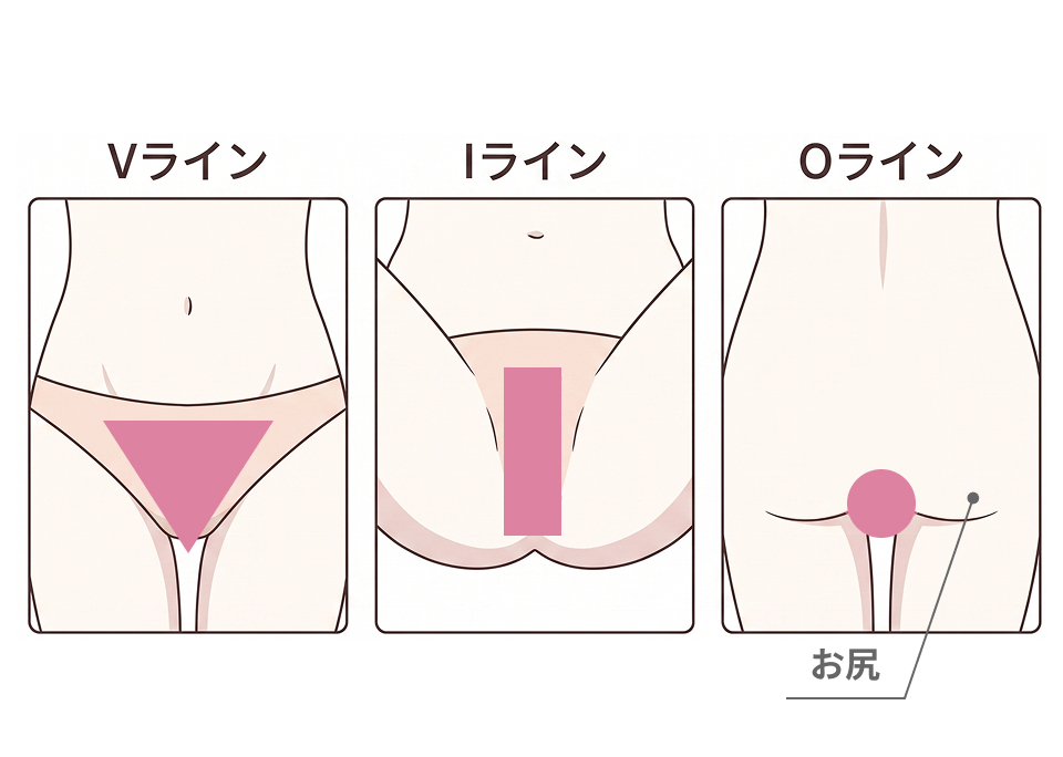 about-vio