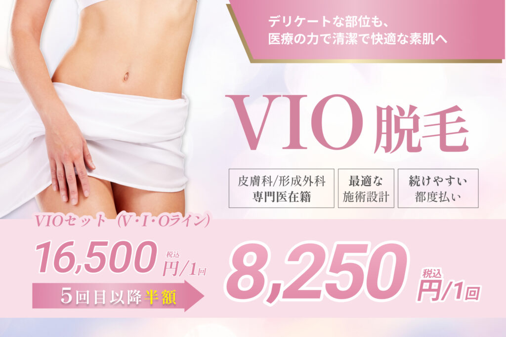 datsumo-vio-fv