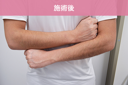 施術後