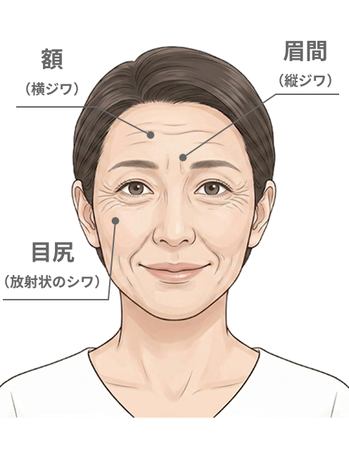 動作時のシワ（表情を作った時のシワ）