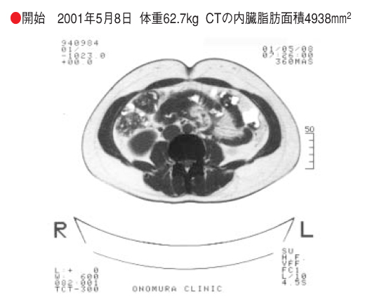 施術前