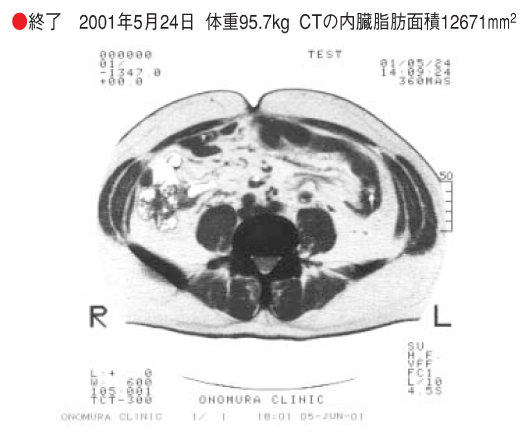 施術後