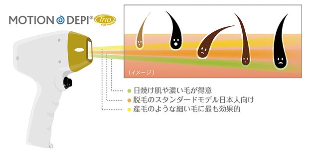 蓄熱脱毛レーザー 今井皮フ形成外科クリニック