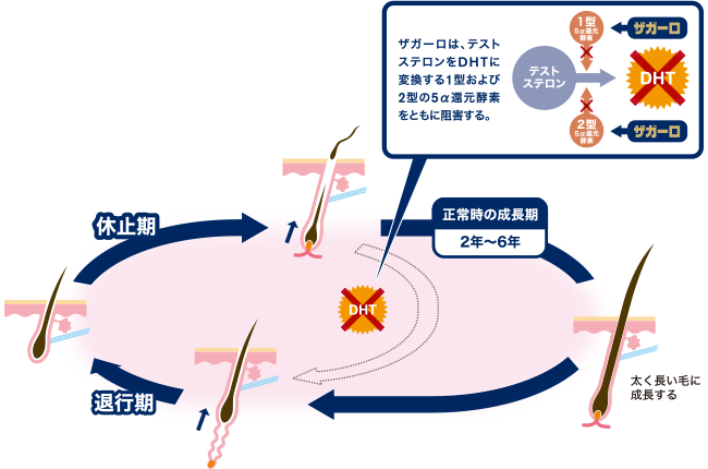 デュタステリド